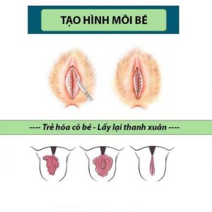 Hồng tân trang cô bé - Giá Chỉ ₫2.000.000